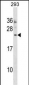 MOSPD3 Antibody (Center)